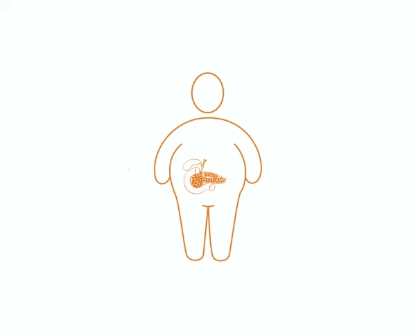 Почему лишний вес — спутник панкреатита