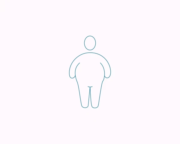 4 поширені міфи про ожиріння