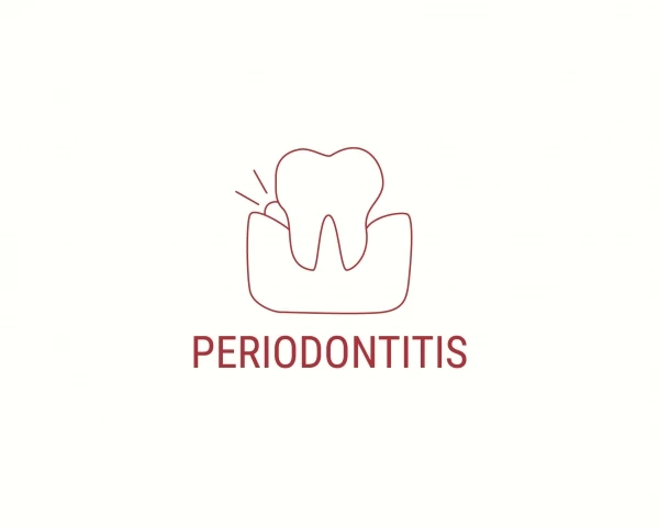 Пародонтит повышает риск сердечно-сосудистых заболеваний: стоматологи