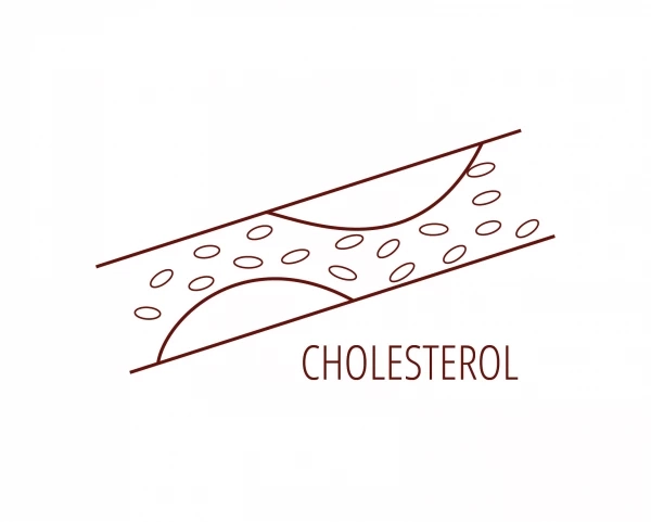 Высокий холестерин не показатель нарушения: врачи