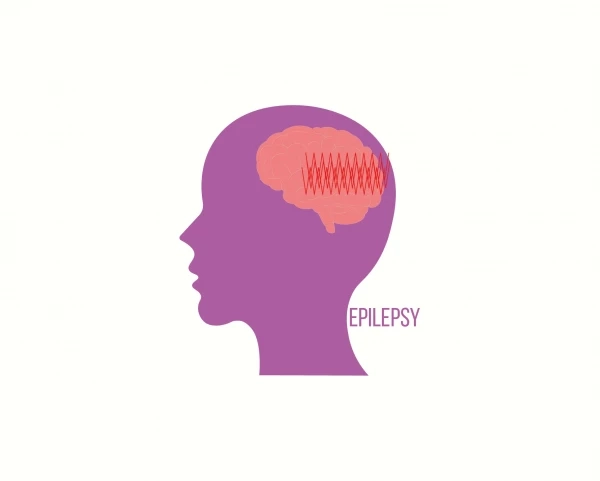Ученые раскрыли механизм хронической эпилепсии