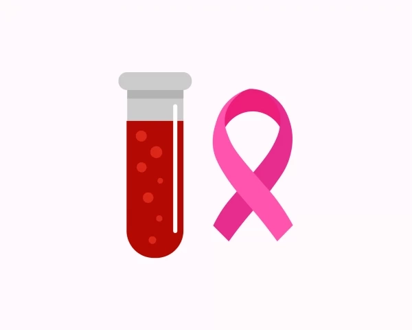 Ризик рецидиву раку молочної залози діагностуватимуть по краплі крові
