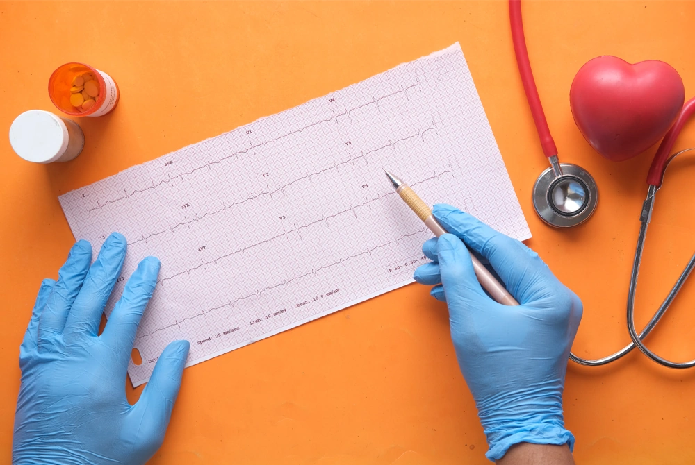лікар перевіряє кардіограму
