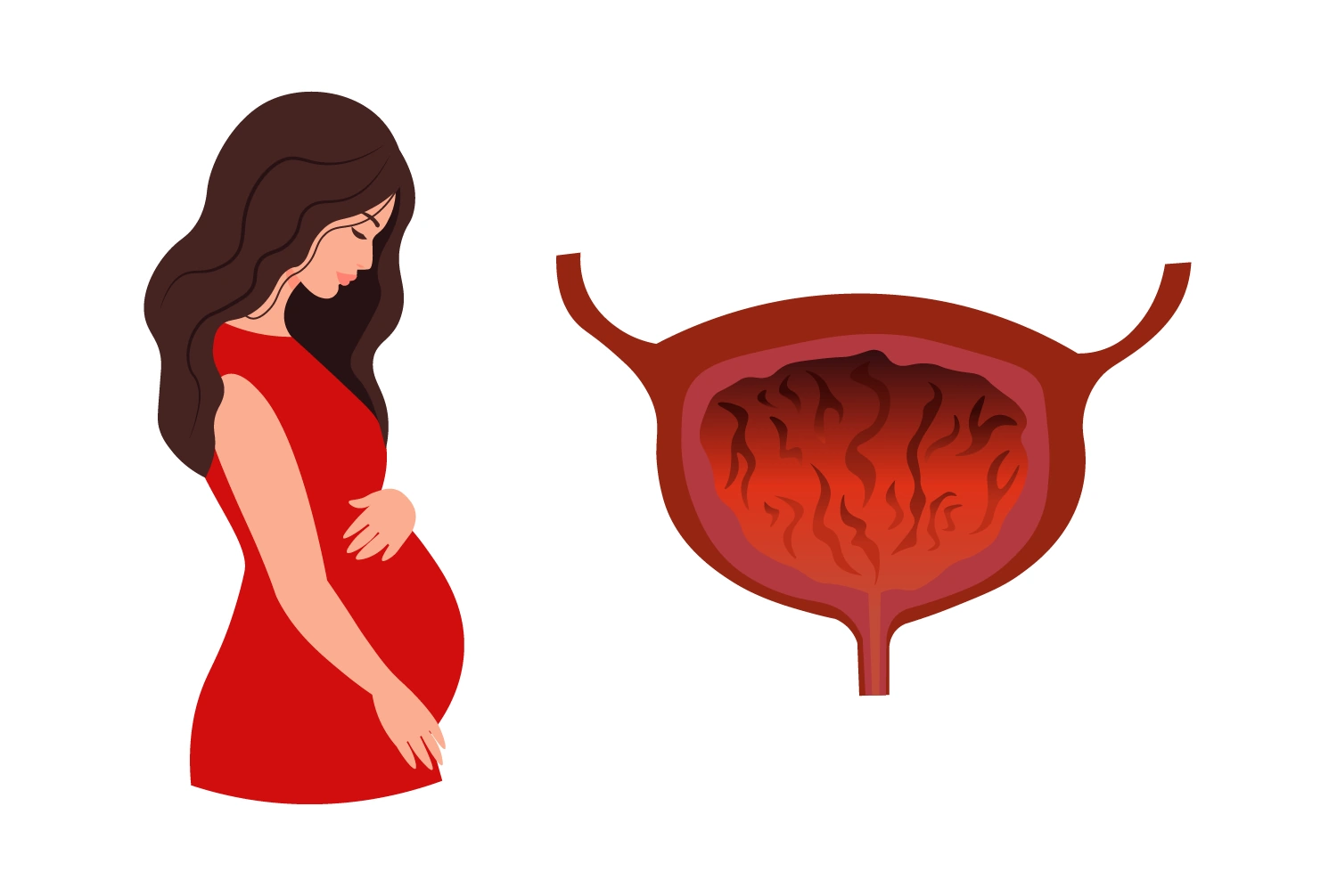 беременная женщина и воспаленный мочевой пузырь