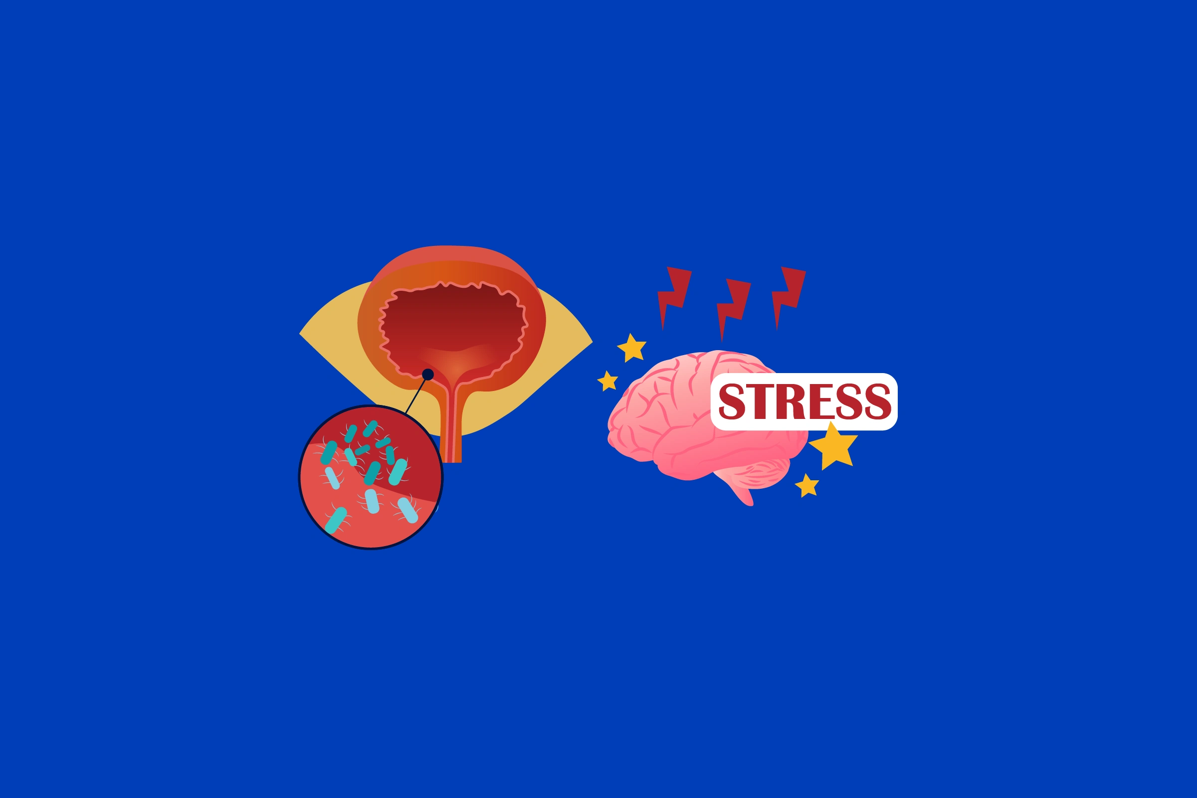 цистит и стресс
